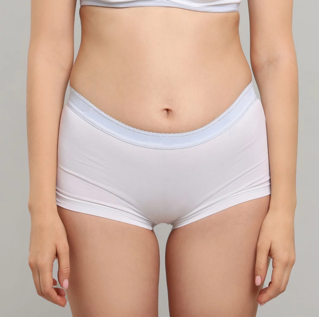 Avant/Après I-Sculpt