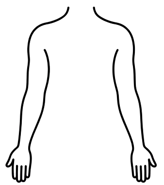 Cryolipolyse bras