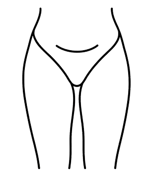 Cryolipolyse cuisses